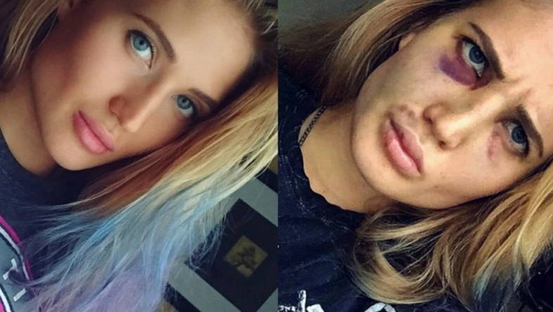 anastasia yankova before after